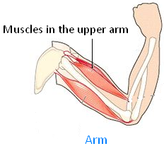 Picture of our Arm