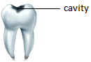 Cavity