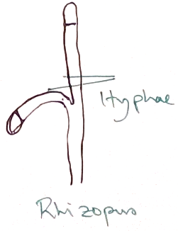 Rhizopus