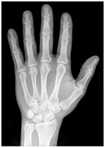 X-ray Picture